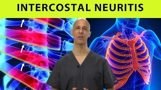 Intercostal Neuritis Relief (Mid Back Pain, Rib & Chest Pain) - Dr Mandell