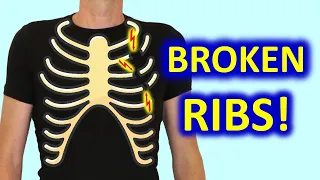 6 Do’s & 6 Don’ts To Recover From Broken Ribs