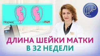 Цервикометрия в 32 недели беременности. Длина шейки матки в 32 недели и далее. Дементьева С.Н.