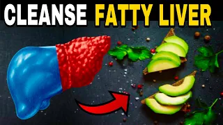 THE BEST WAY to CLEAN FAT in the LIVER | 5 Best and Worst Foods for FATTY LIVER