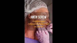 Коррекция губоподбородочных складок с применением мезонитей Screw/Пружинка