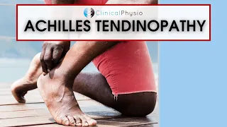 Achilles Tendinopathy | Best Physio Assessment and Treatment Tips!