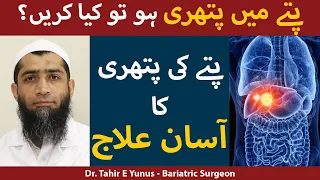 Pittay Ki Pathri Ka Ilaj In Urdu | Gallstones Treatment In Urdu/Hindi | Dr. Tahir E Yunus