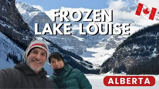 Explore the Frozen Beauty of Lake Louise in the Canadian Rockies!