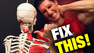 How to Fix a Stiff Neck in Seconds (THIS WORKS!)