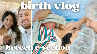 BIRTH VLOG SCHEDULED C-SECTION 2022 | breech, failed ecv, *POSITIVE* experience