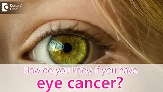 How do you know if you have eye cancer? - Dr. Sunita Rana Agarwal