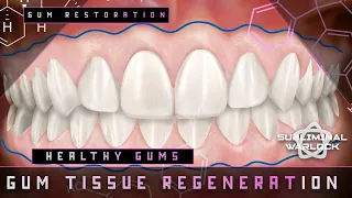 Full Gum Tissue Regeneration - Energetically Programmed Audio - Sub Warlock