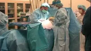 C-section in St. Luke's Birth Care Center operating rooms video