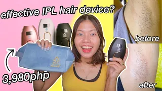 TRYING IPL HAIR REMOVAL DEVICE FROM DIY SMOOTH FOR A MONTH! MY HONEST EXPERIENCE + IS IT WORKING?!