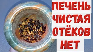 ПЕЧЕНЬ и ЖЕЛЧНЫЙ пузырь в НОРМЕ, отёков больше НЕТ