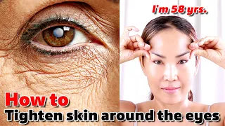 How to Tighten skin around the eyes - Wrinkles around the eyes | NO TALKING | Facial Massage