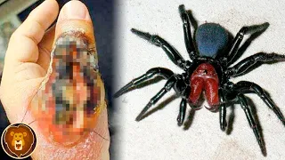 Las 10 Picaduras De Araña Más Venenosas Del Mundo