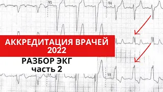 Разбор ЭКГ из АККРЕДИТАЦИИ 2022 года (для кардиологов, терапевтов, функциональных диагностов)Часть 2