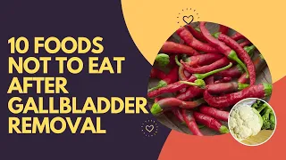 10 Foods Not to Eat After Gallbladder Removal