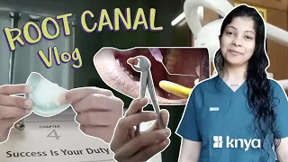 Root Canal vlog by doctor Jasmine Battisi @DoctorBattisi