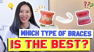 Types of Braces COMPARED & EXPLAINED! | #BraceYourself!🦷