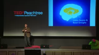 Why TED talks don't change your life much: Neale Martin at TEDxPeachtree