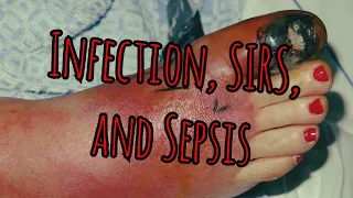 Recycled Prolonged Fieldcare Podcast 19: Infection, SIRS, and Sepsis