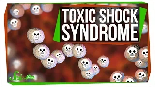 Toxic Shock Syndrome: Way Beyond Tampons