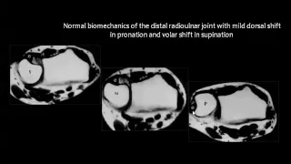 Imaging of Wrist joint jordan Aug 2014   Dr Mamdouh Mahfouz In Arabic 720p