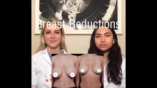 Breast Reductions with Sam & Meg