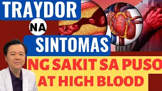 Traydor na Sintomas ng Sakit sa Puso at High Blood. - By Doc Willie Ong