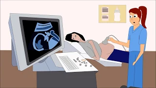 What is Preeclampsia| Preeclampsia Animated| Eclampsia