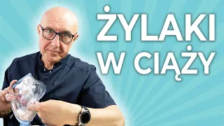 Jak sobie radzić z żylakami w ciąży?