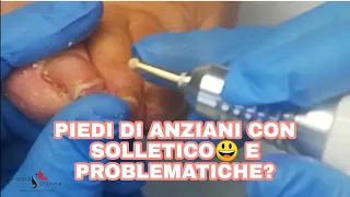 [ PIEDI DI ANZIANI CON SOLLETICO E PROBLEMATICHE? #ArmoniaDonna #Grazia #Santangelo