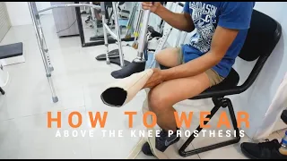 How to Wear Above the Knee Prosthetic Leg