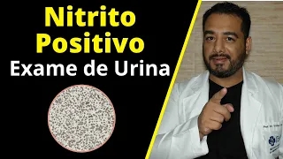 Nitrito positivo na urina: o que significa? E nitrito ausente no exame de urina tipo 1 (EAS)?