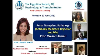 Renal Transplant Pathology: Antibody Mediated Rejection & Differential diagnosis. Prof. Wesam Ismail