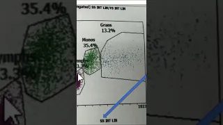 What is Flow Cytometry? #pathagonia #flowcytometry #hemepath #heme #lymphoma #hematology #lymphomas