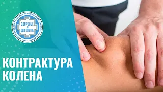 🦵 Не разгибается колено при ходьбе - контрактура коленного сустава