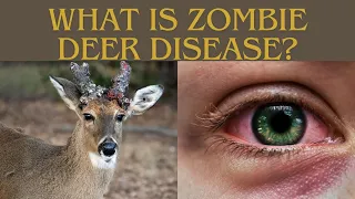U.S. CWD Outbreak: Can Zombie Deer Disease Spread To Humans?