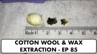COTTON WOOL & EAR WAX REMOVAL - EP 85
