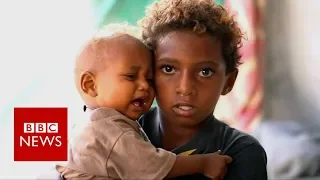 Yemen: Where children rummage through rubbish for food - BBC News