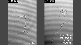 Neuronal growth when treated with the lion’s mane mushroom extract (right)