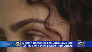 Woman Beaten In The Loop Says Attack Left Her With Physical And Mental Scars