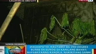 BP: Magkapatid, nagtamo ng 2nd degree burns sa sunog sa kanilang bahay sa CdeO