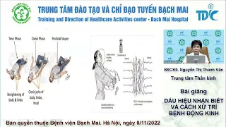 Dấu hiệu nhận biết và cách xử trí bệnh Động kinh