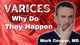 Varices - What Are They And Why They Occur?