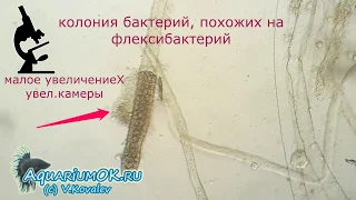 Как выглядит сапролегниоз (Saprolegniasis) рыбы под микроскопом. Зооспорангии и зооспоры.