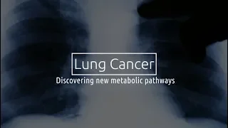 Small Cell Lung Cancer: Discovering New Metabolic Pathways