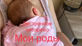 Мои роды//Роддом 9 Пермь//Кесарево//Первые дни после родов