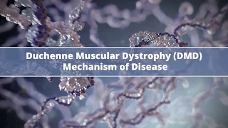 Duchenne Muscular Dystrophy (DMD) Mechanism of Disease