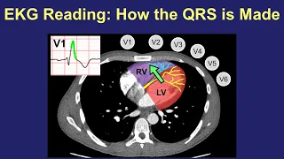 EKG Reading: How the QRS is Made