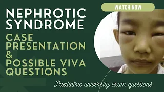 Nephrotic syndrome - Case presentation (History)