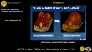 Stereotactic navigation for rectal surgery